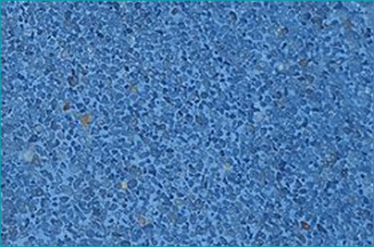 King Pools & Spas - Plaster